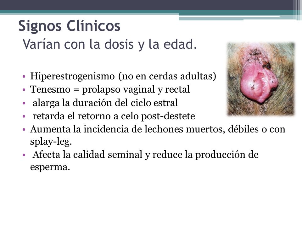 Signos Clínicos Varían con la dosis y la edad.