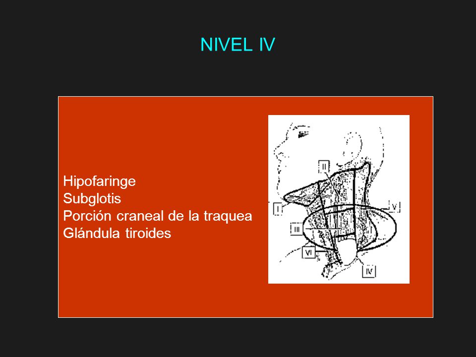 NIVEL IV Hipofaringe Subglotis Porción craneal de la traquea
