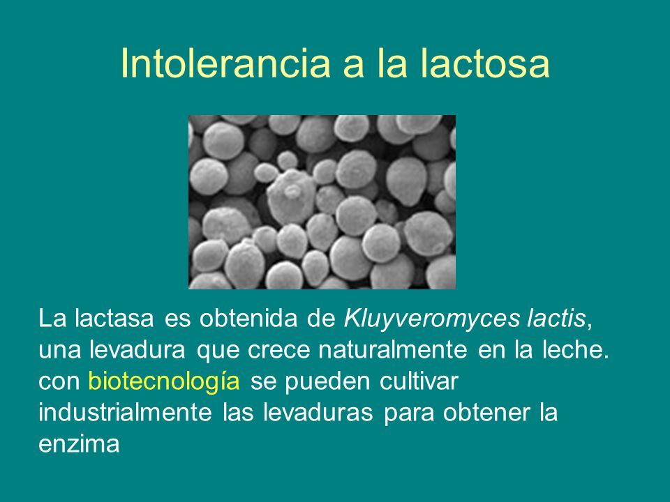 Intolerancia a la lactosa
