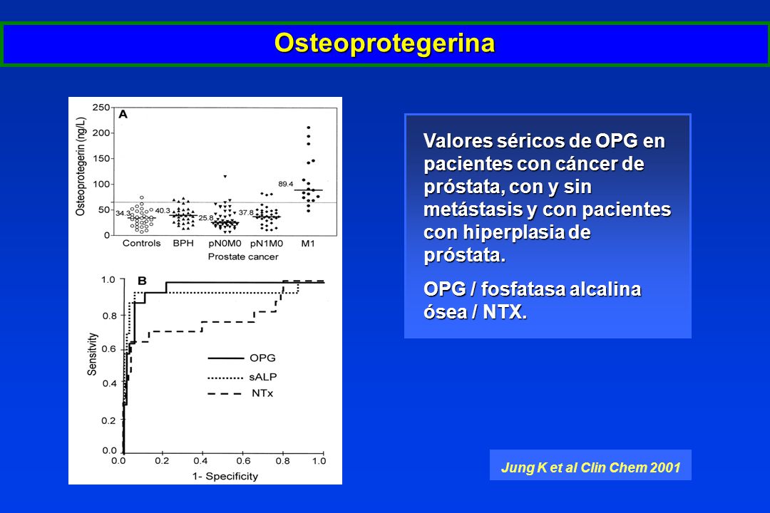 Osteoprotegerina Valores séricos de OPG en pacientes con cáncer de próstata, con y sin metástasis y con pacientes con hiperplasia de próstata.