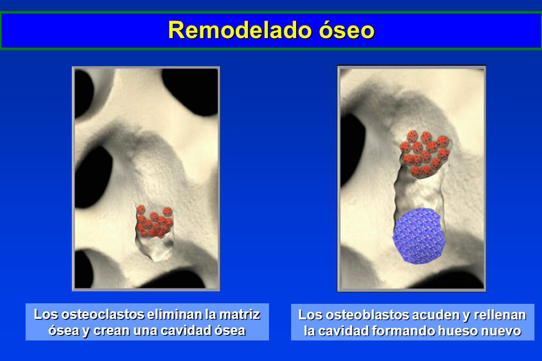 Remodelado óseo Los osteoclastos eliminan la matriz ósea y crean una cavidad ósea.