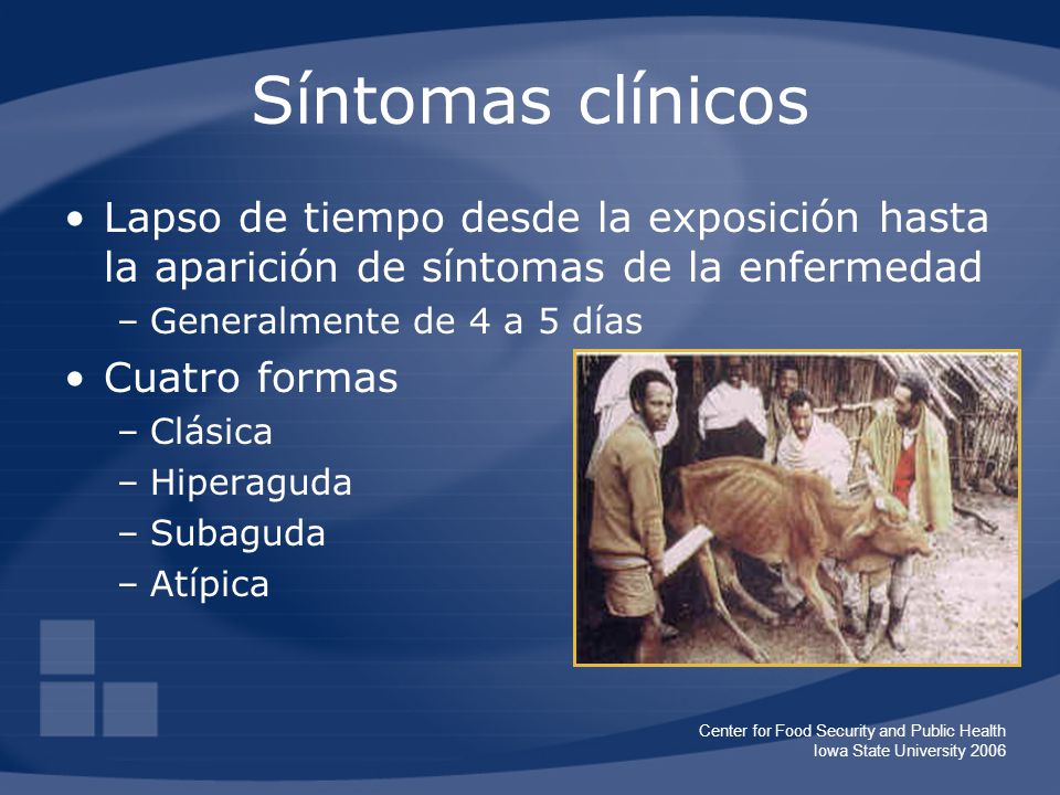 Síntomas clínicos Lapso de tiempo desde la exposición hasta la aparición de síntomas de la enfermedad.