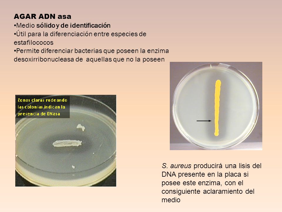 AGAR ADN asa Medio sólido y de identificación. Útil para la diferenciación entre especies de estafilococos.