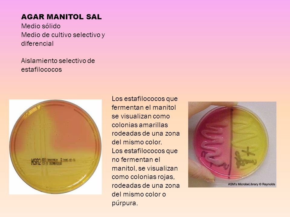 AGAR MANITOL SAL Medio sólido. Medio de cultivo selectivo y diferencial. Aislamiento selectivo de estafilococos.