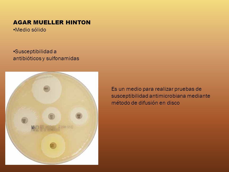 AGAR MUELLER HINTON Medio sólido. Susceptibilidad a antibióticos y sulfonamidas.