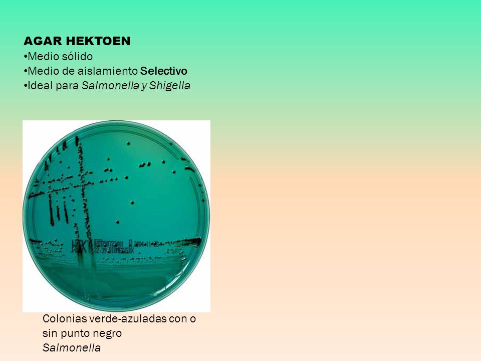AGAR HEKTOEN Medio sólido. Medio de aislamiento Selectivo. Ideal para Salmonella y Shigella. Colonias verde-azuladas con o sin punto negro.