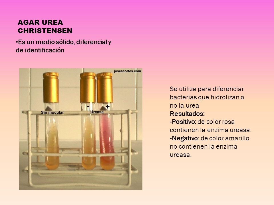 AGAR UREA CHRISTENSEN Es un medio sólido, diferencial y de identificación. Se utiliza para diferenciar bacterias que hidrolizan o no la urea.