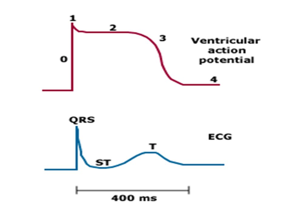 ONDA P: DESPOLARIZACIÓN AURICULAR. (0,10 SEG X 0,12 A 0,25 MV)