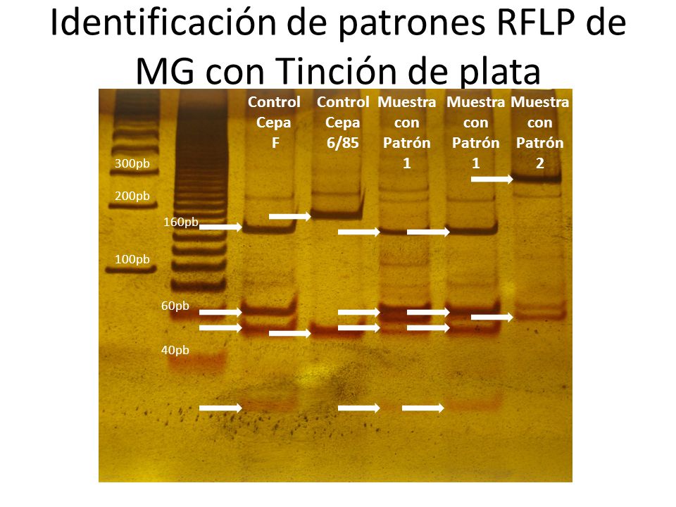 Identificación de patrones RFLP de MG con Tinción de plata