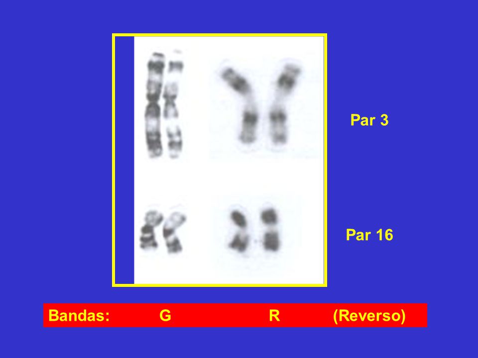 Par 3 Par 16 Bandas: G R (Reverso)