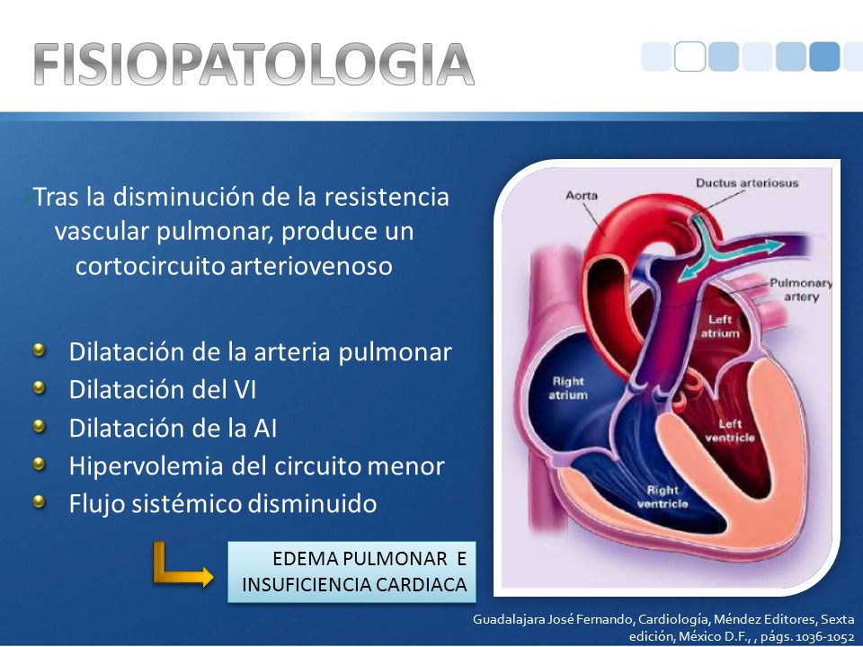 FISIOPATOLOGIA Tras la disminución de la resistencia vascular pulmonar, produce un cortocircuito arteriovenoso.