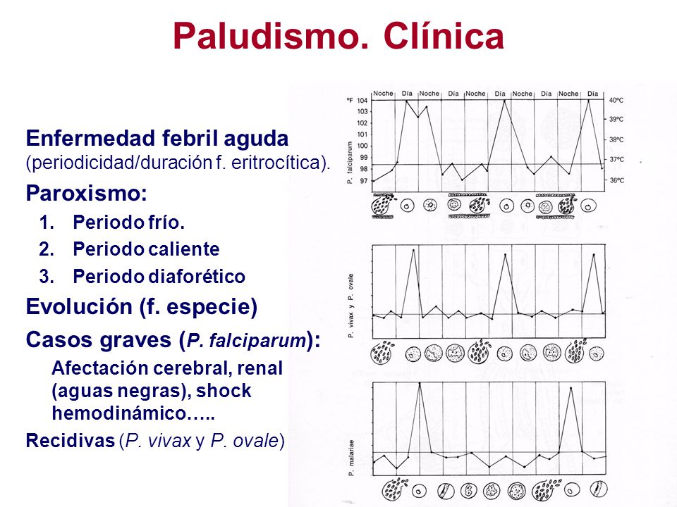 Paludismo. Clínica Enfermedad febril aguda (periodicidad/duración f. eritrocítica). Paroxismo: Periodo frío.