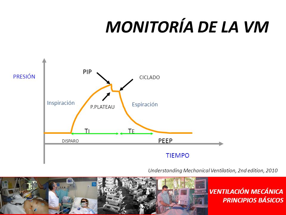 MONITORÍA DE LA VM PEEP TI TE PIP TIEMPO VENTILACIÓN MECÁNICA