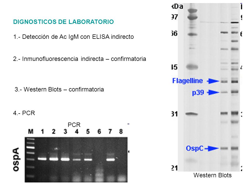 Western Blots 3.- Western Blots – confirmatoria. DIGNOSTICOS DE LABORATORIO. 1.- Detección de Ac IgM con ELISA indirecto.