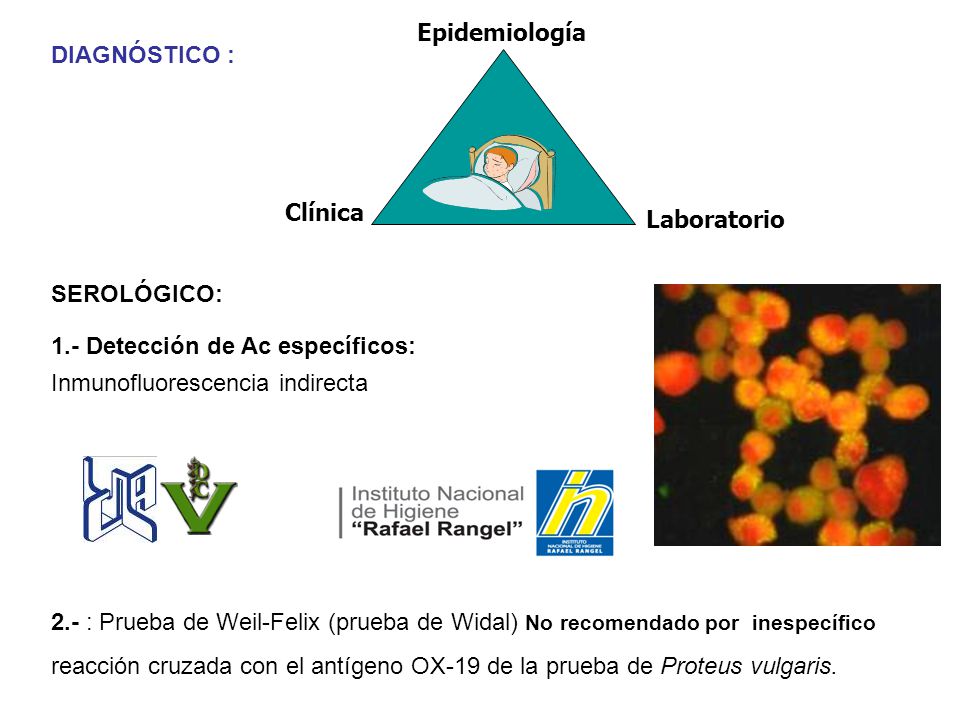 Epidemiología Laboratorio. Clínica. DIAGNÓSTICO : SEROLÓGICO: 1.- Detección de Ac específicos: Inmunofluorescencia indirecta.