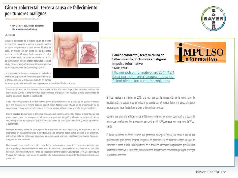 Cáncer colorretal, tercera causa de fallecimiento por tumores malignos