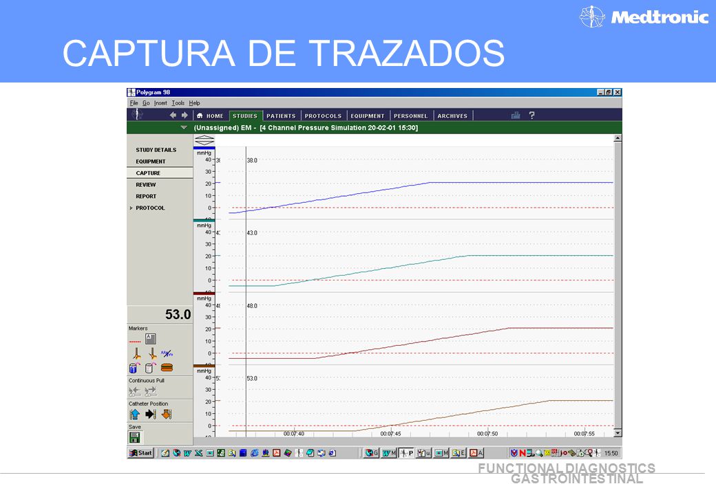 CAPTURA DE TRAZADOS What to present in the Capture view: