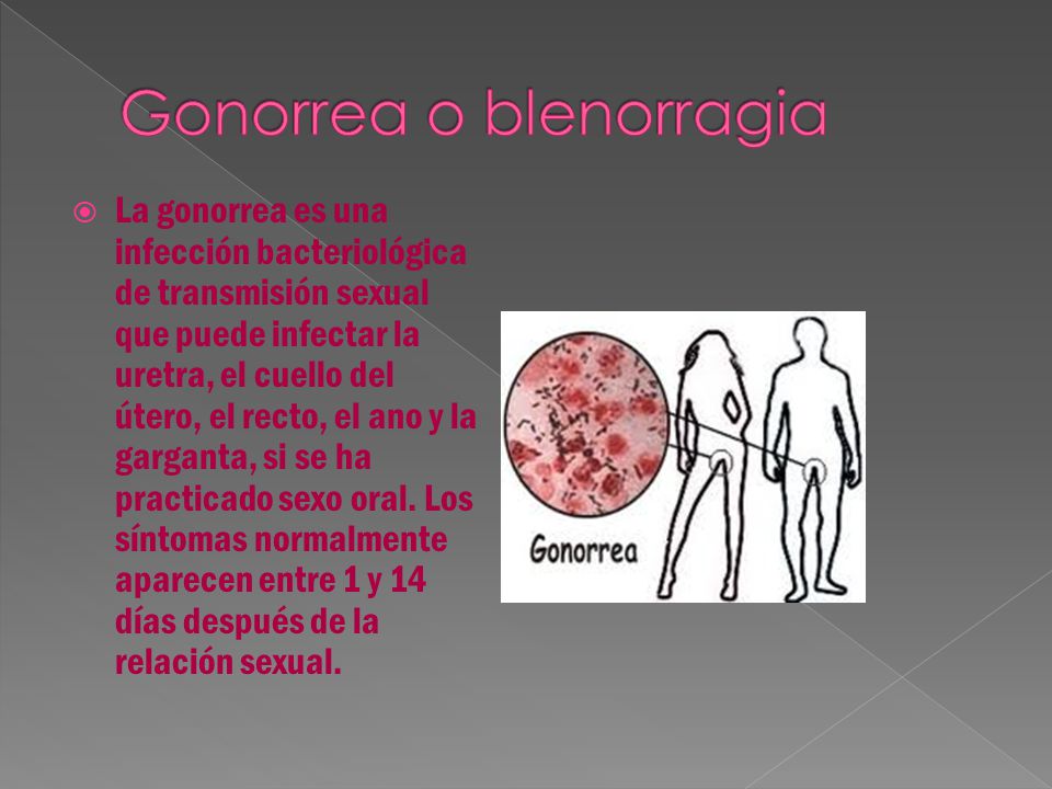 Gonorrea o blenorragia