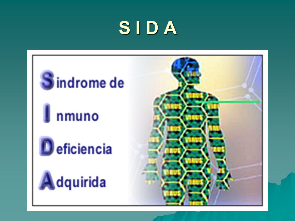 S I D A S INDROME de I NMUNO D EFICIECIA A DQUIRIDA