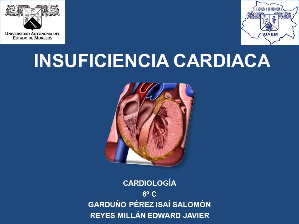 CARDIOLOGÍA 6º C GARDUÑO PÉREZ ISAÍ SALOMÓN REYES MILLÁN EDWARD JAVIER