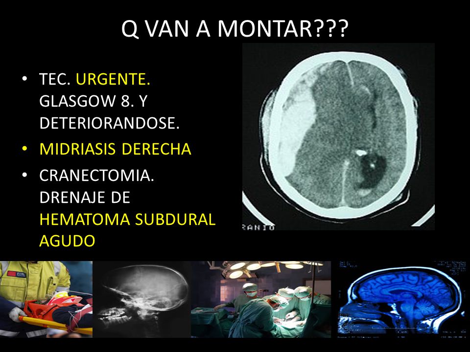 Q VAN A MONTAR TEC. URGENTE. GLASGOW 8. Y DETERIORANDOSE.