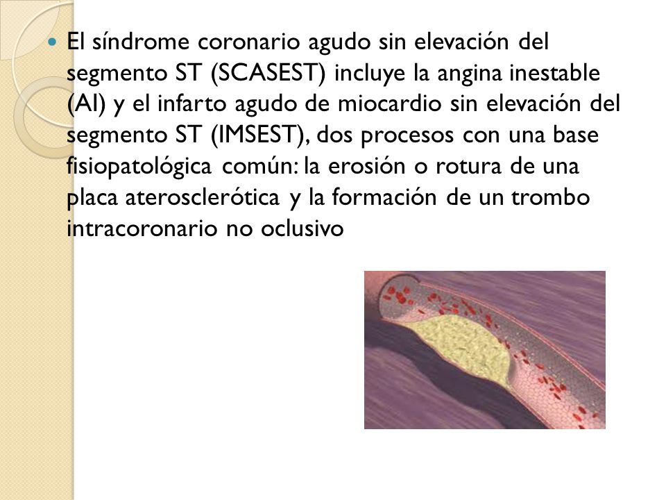 El síndrome coronario agudo sin elevación del segmento ST (SCASEST) incluye la angina inestable (AI) y el infarto agudo de miocardio sin elevación del segmento ST (IMSEST), dos procesos con una base fisiopatológica común: la erosión o rotura de una placa aterosclerótica y la formación de un trombo intracoronario no oclusivo