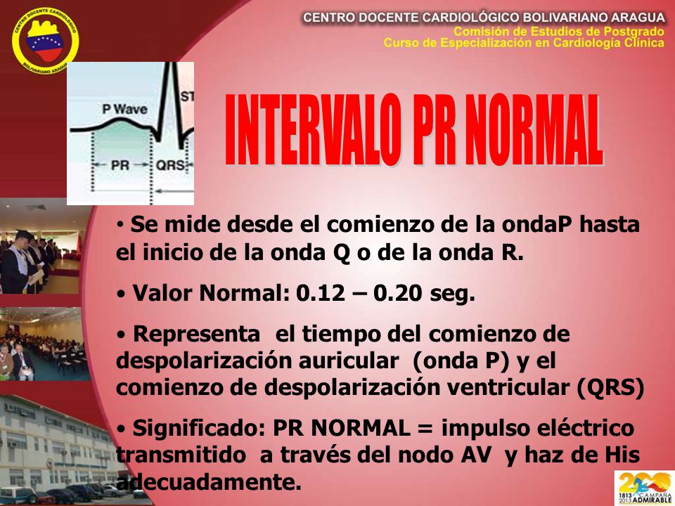 INTERVALO PR NORMAL Se mide desde el comienzo de la ondaP hasta el inicio de la onda Q o de la onda R.