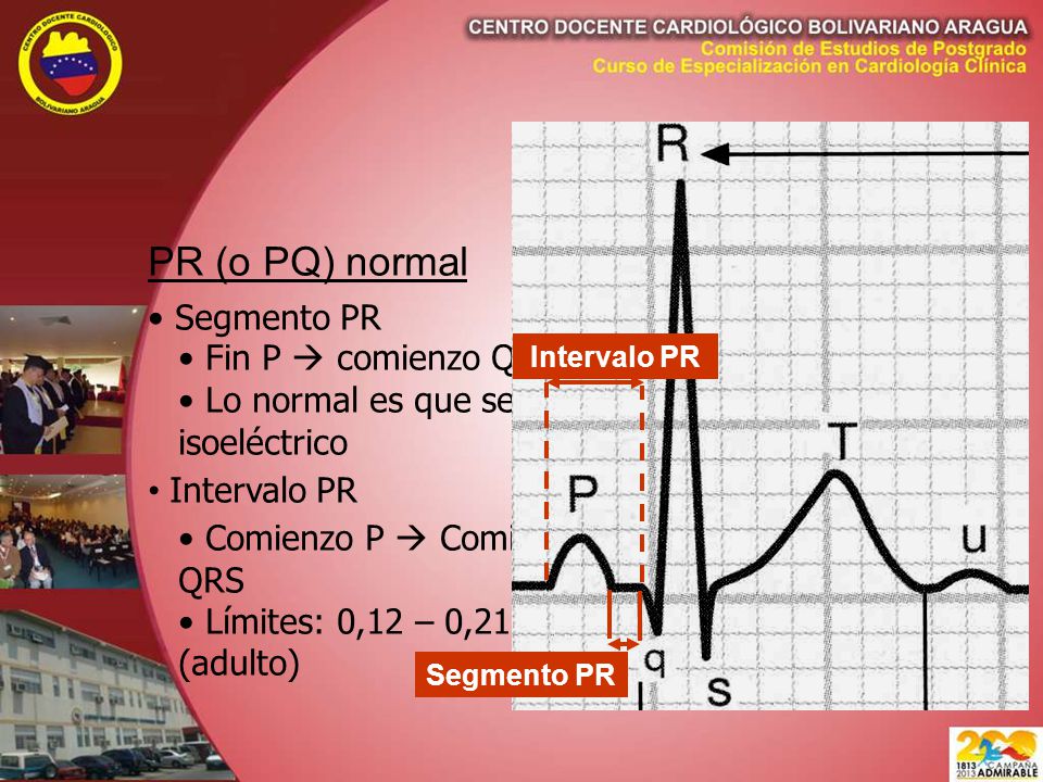 PR (o PQ) normal Segmento PR Fin P  comienzo QRS