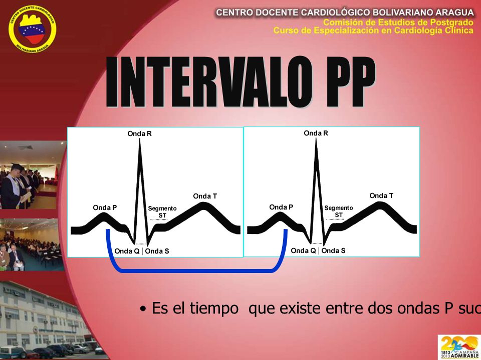 INTERVALO PP Es el tiempo que existe entre dos ondas P sucesivas.