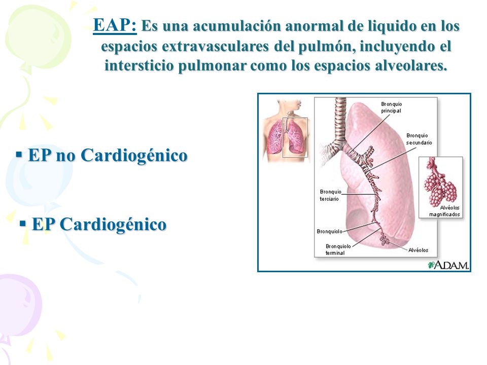 EAP: Es una acumulación anormal de liquido en los espacios extravasculares del pulmón, incluyendo el intersticio pulmonar como los espacios alveolares.