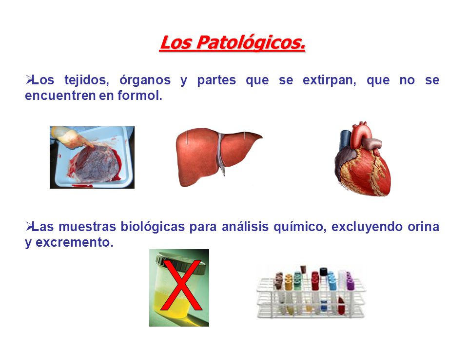 Los Patológicos. Los tejidos, órganos y partes que se extirpan, que no se encuentren en formol.