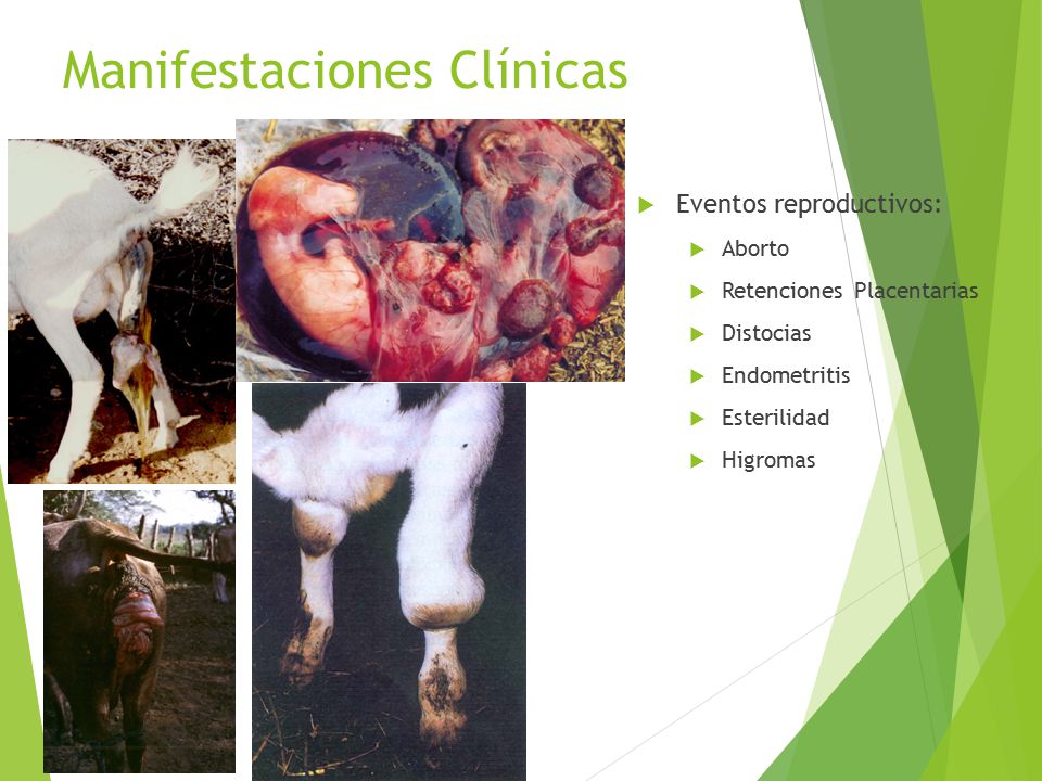 Manifestaciones Clínicas
