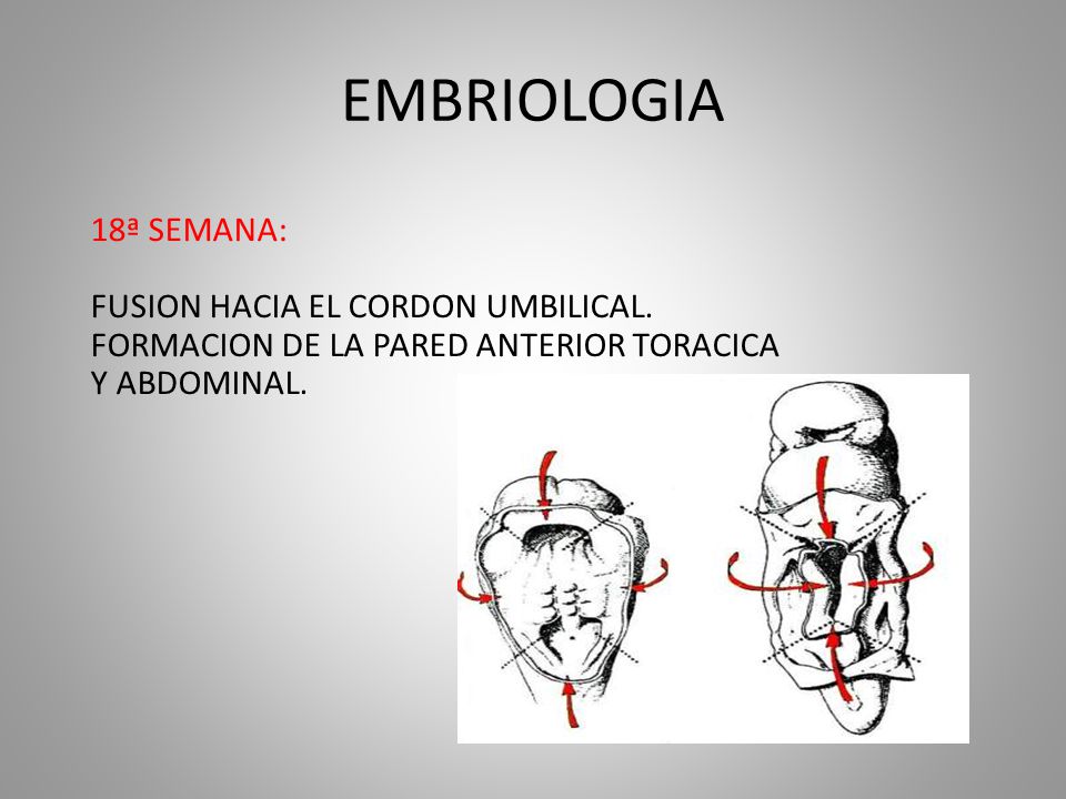 EMBRIOLOGIA 18ª SEMANA: FUSION HACIA EL CORDON UMBILICAL.