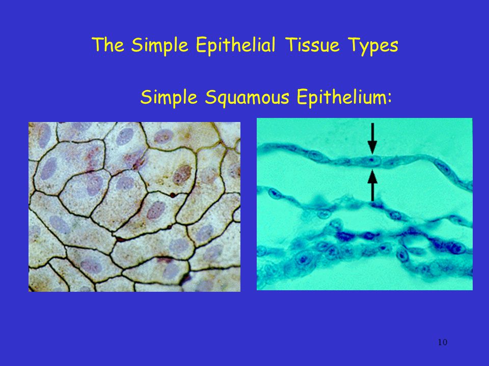 The Simple Epithelial Tissue Types