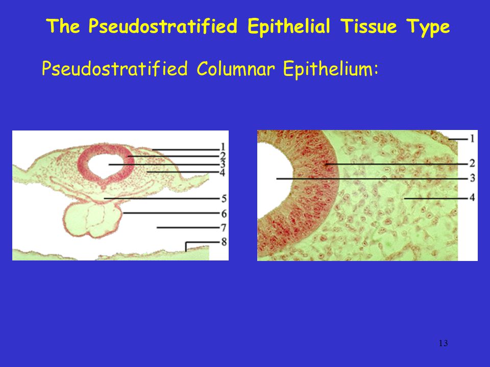 The Pseudostratified Epithelial Tissue Type
