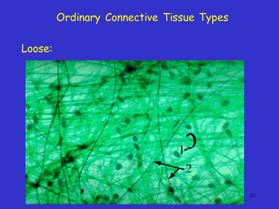 Ordinary Connective Tissue Types