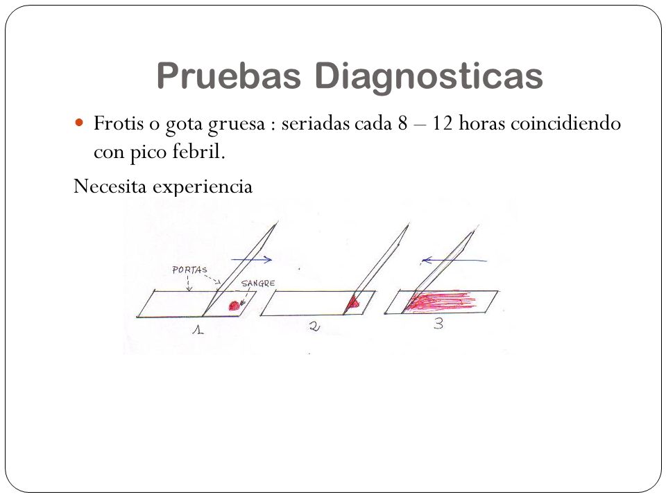 Pruebas Diagnosticas Frotis o gota gruesa : seriadas cada 8 – 12 horas coincidiendo con pico febril.
