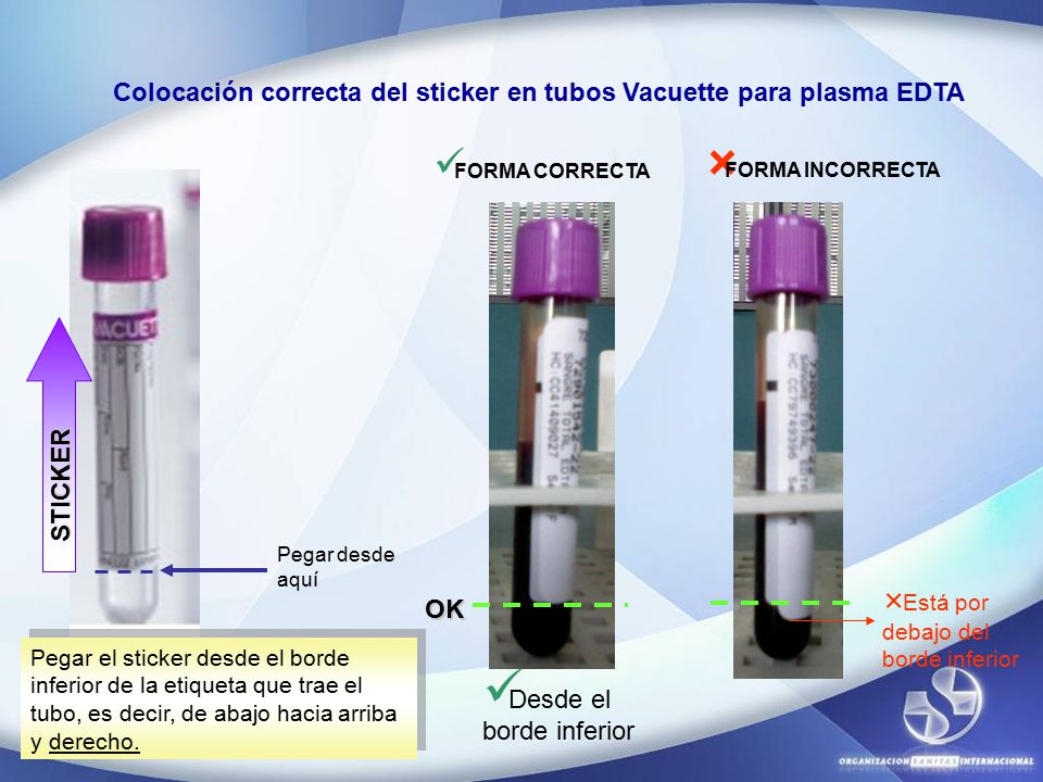 Colocación correcta del sticker en tubos Vacuette para plasma EDTA