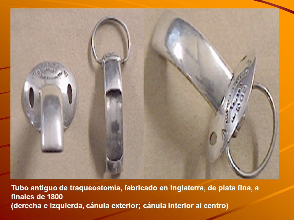Tubo antiguo de traqueostomía, fabricado en Inglaterra, de plata fina, a finales de 1800 (derecha e izquierda, cánula exterior; cánula interior al centro)