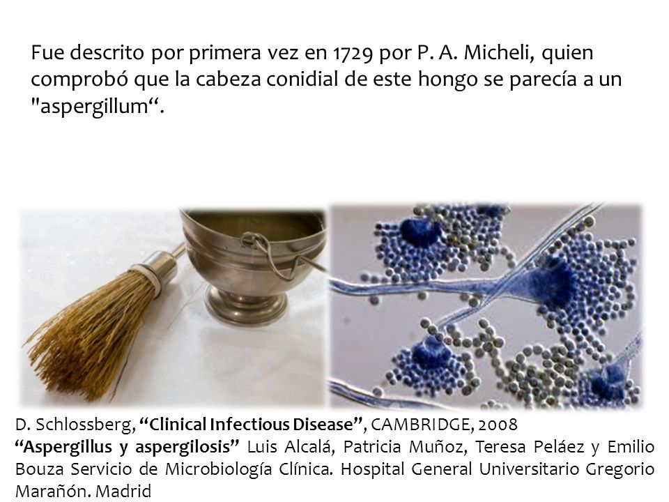 Fue descrito por primera vez en 1729 por P. A