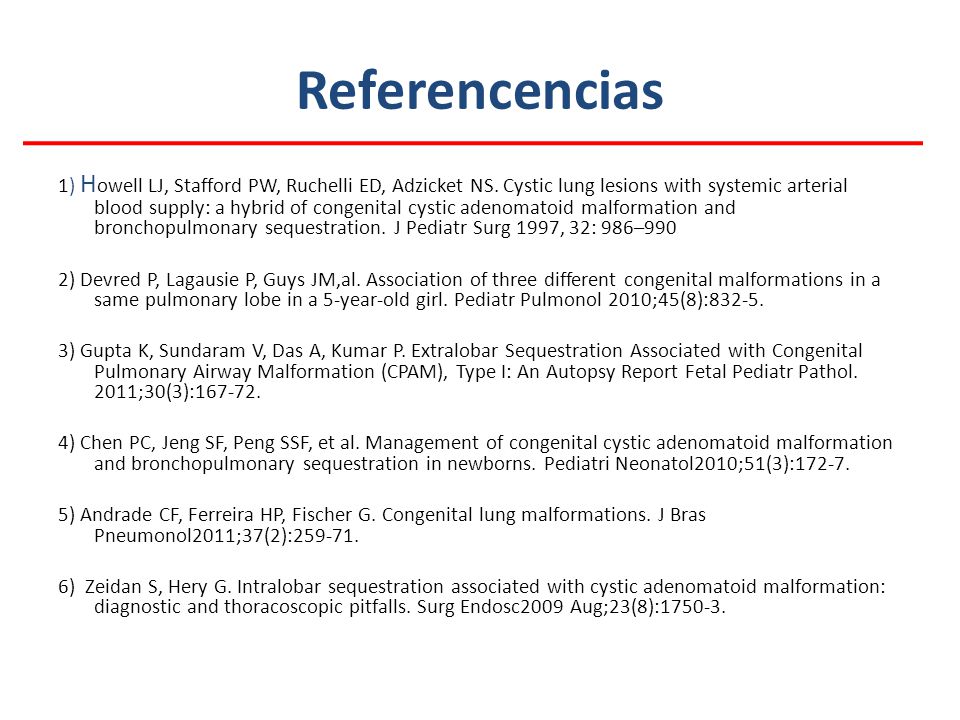Referencencias