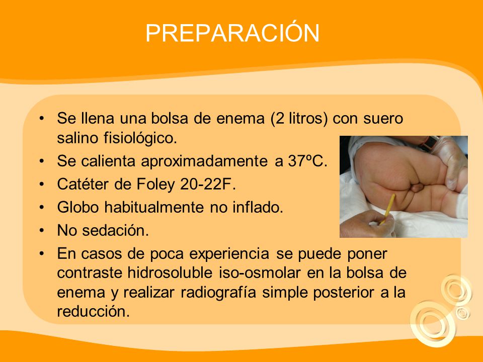 PREPARACIÓN Se llena una bolsa de enema (2 litros) con suero salino fisiológico. Se calienta aproximadamente a 37ºC.
