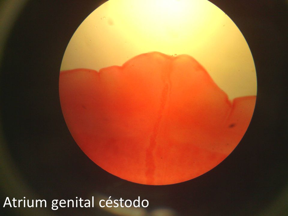 Atrium genital céstodo