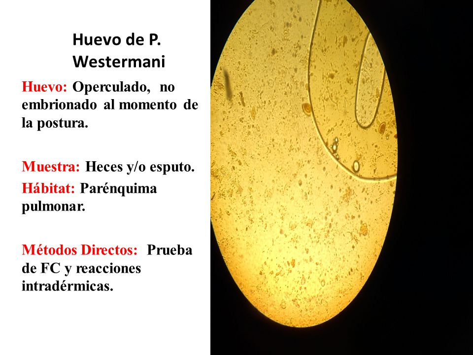 Huevo de P. Westermani Huevo: Operculado, no embrionado al momento de la postura. Muestra: Heces y/o esputo.