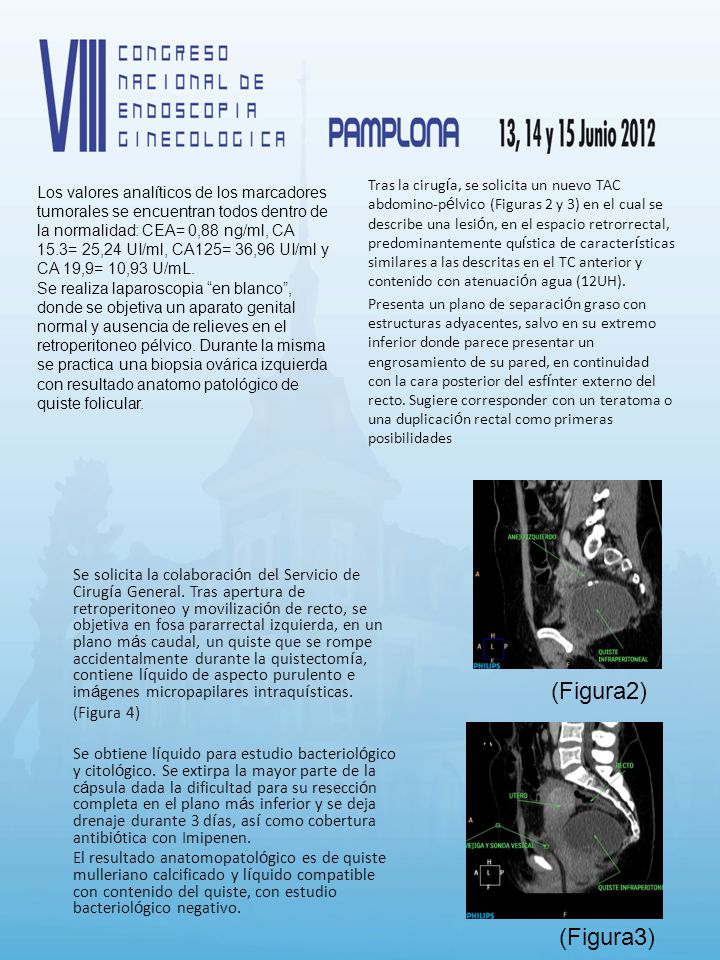 Tras la cirugía, se solicita un nuevo TAC abdomino-pélvico (Figuras 2 y 3) en el cual se describe una lesión, en el espacio retrorrectal, predominantemente quística de características similares a las descritas en el TC anterior y contenido con atenuación agua (12UH).