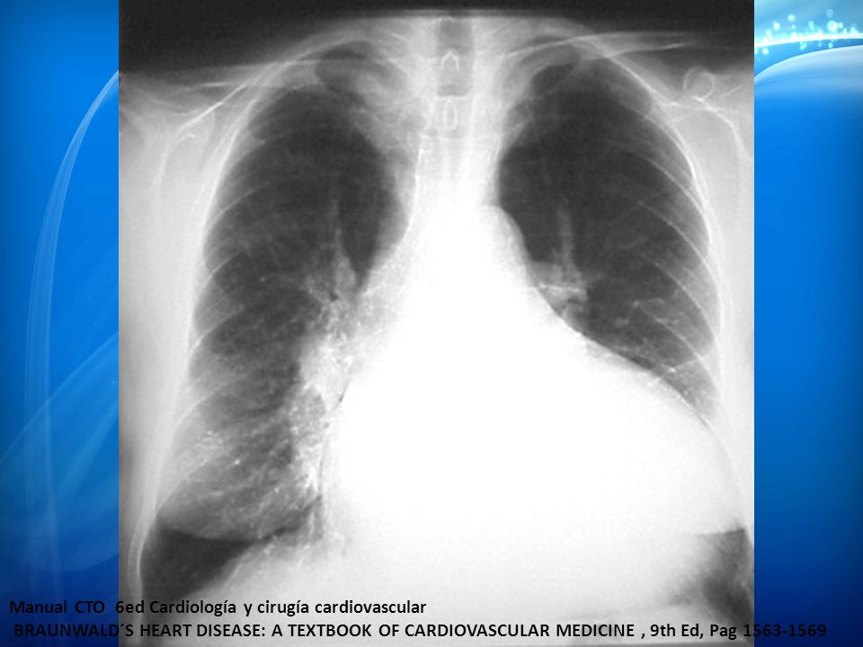 Manual CTO 6ed Cardiología y cirugía cardiovascular