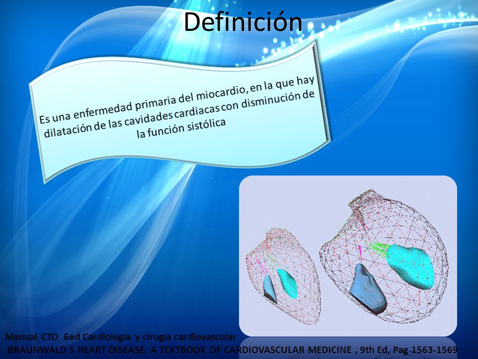 Definición Es una enfermedad primaria del miocardio, en la que hay dilatación de las cavidades cardiacas con disminución de la función sistólica.