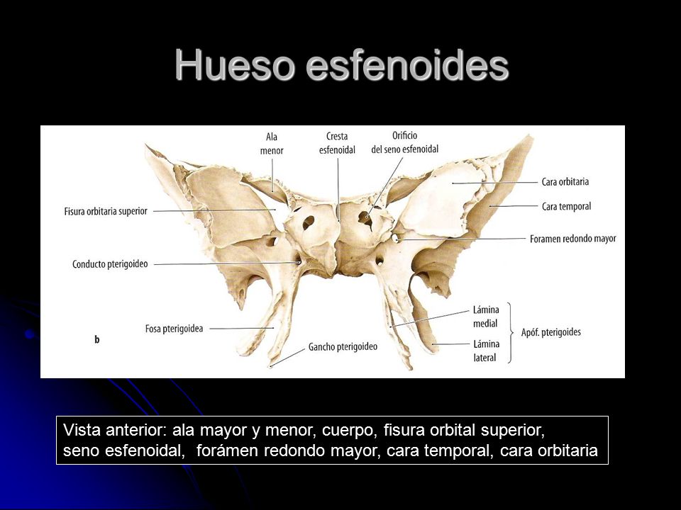 Hueso esfenoides Vista anterior: ala mayor y menor, cuerpo, fisura orbital superior,