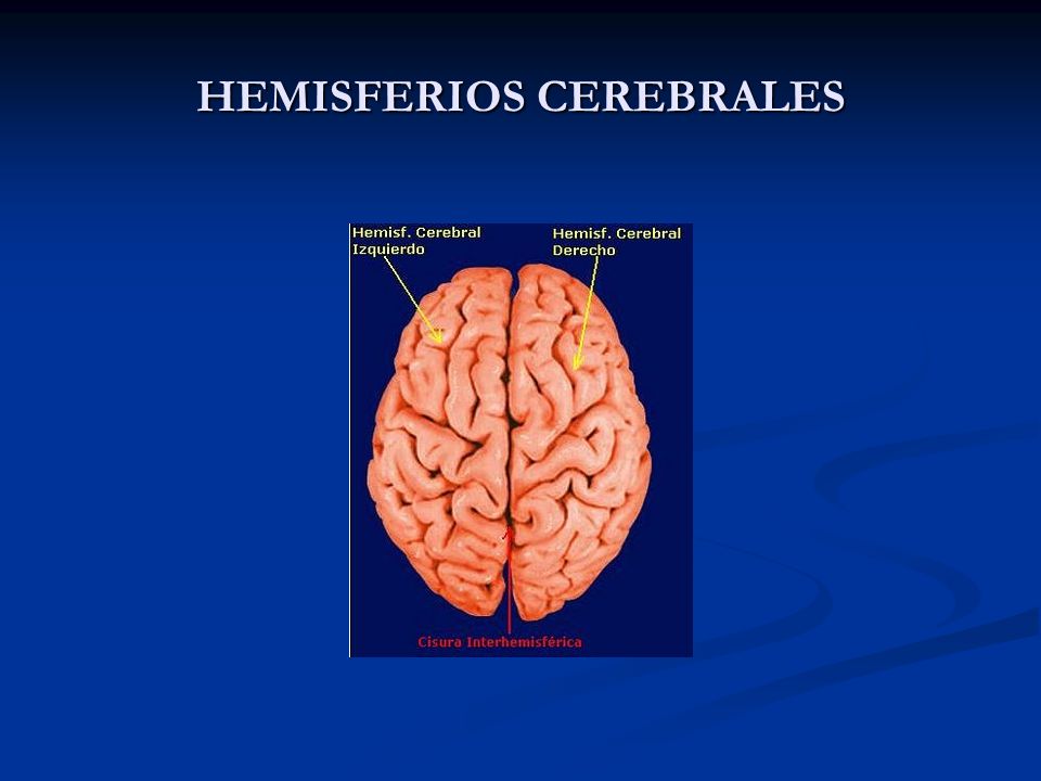 HEMISFERIOS CEREBRALES