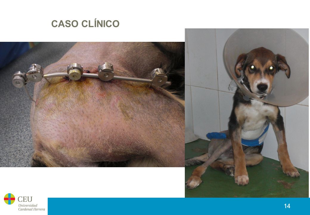 CASO CLÍNICO